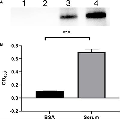 Factor H Is Bound by Outer Membrane-Displayed Carbohydrate Metabolism Enzymes of Extraintestinal Pathogenic Escherichia coli and Contributes to Opsonophagocytosis Resistance in Bacteria